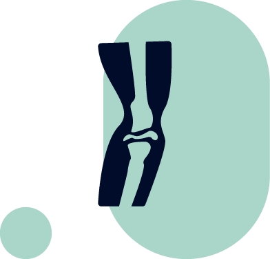 Image illustrant l'arthrose et l'utilisation du CBD