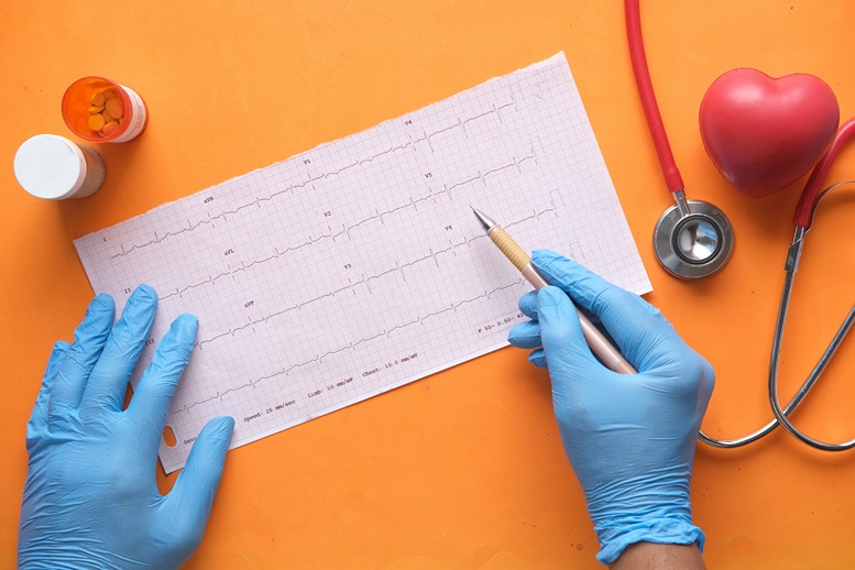 Médecin analysant un électrocardiogramme avec stéthoscope et médicaments pour évaluer les interactions CBD avec les traitements cardiaques